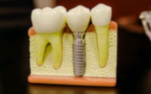 小熊拔牙教案15篇